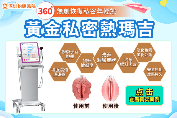 深圳壓力性尿失禁問題有什麼治療方案
