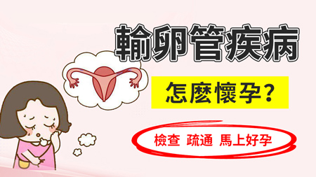 深圳輸卵管堵塞怎麼辦?中西醫精準治療