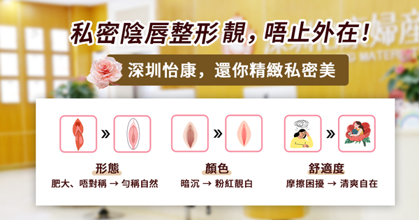 香港人可以預約深圳割陰唇手術嗎?陰唇手術流程與收費